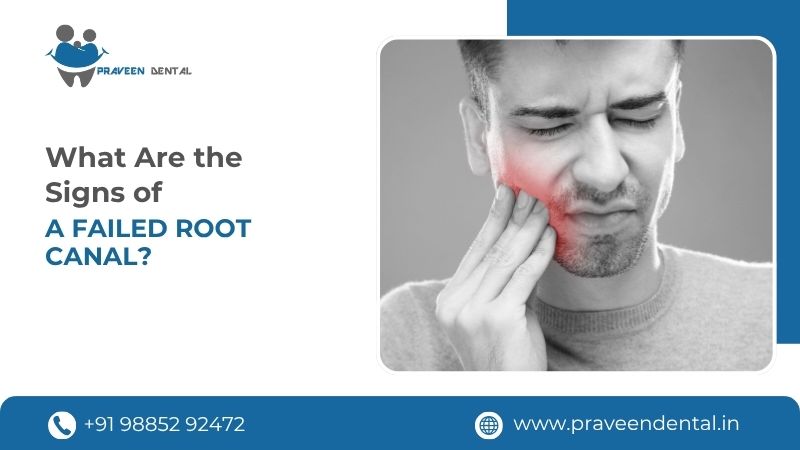 Signs of a Failed Root Canal